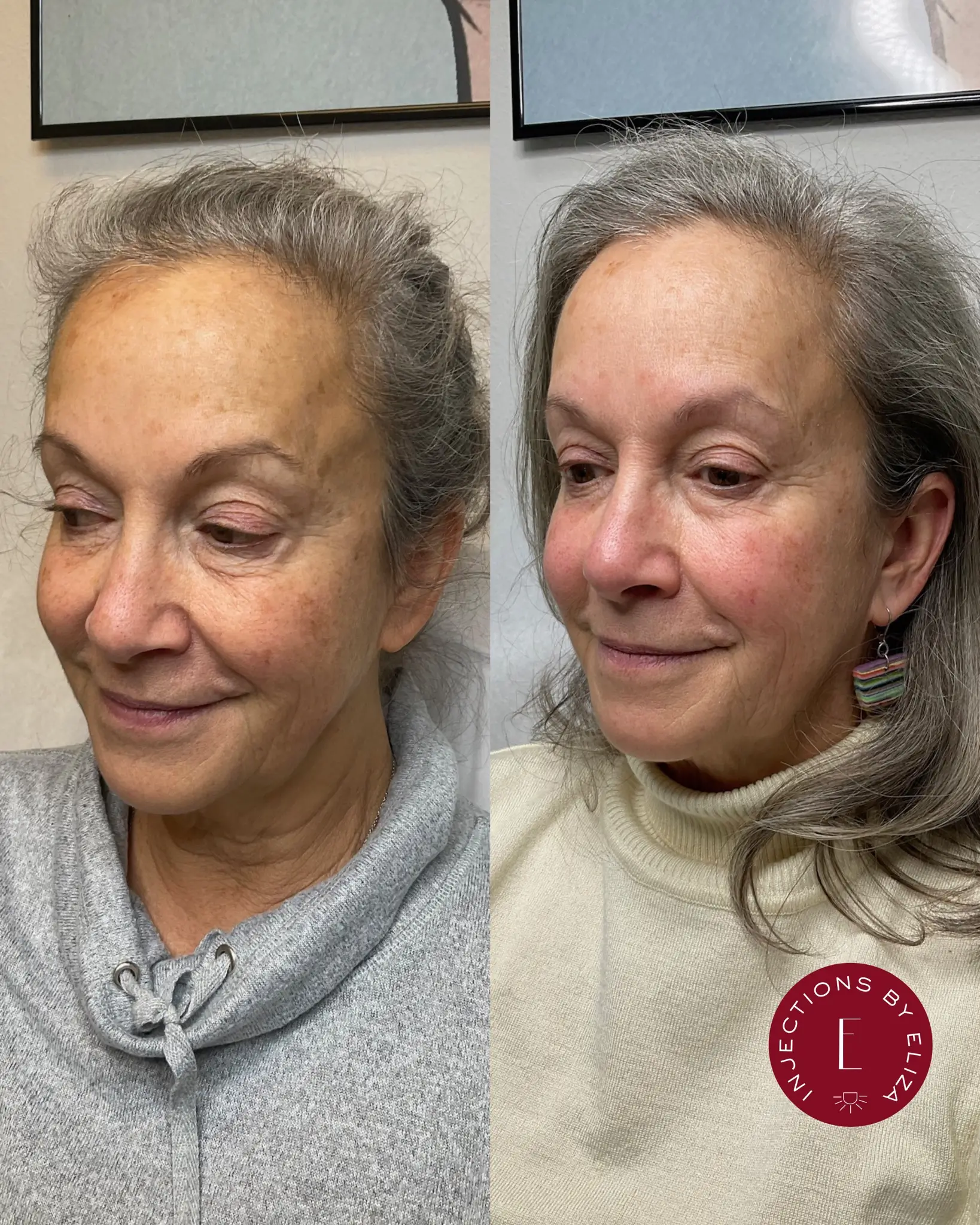 Treat aging concerns, 3